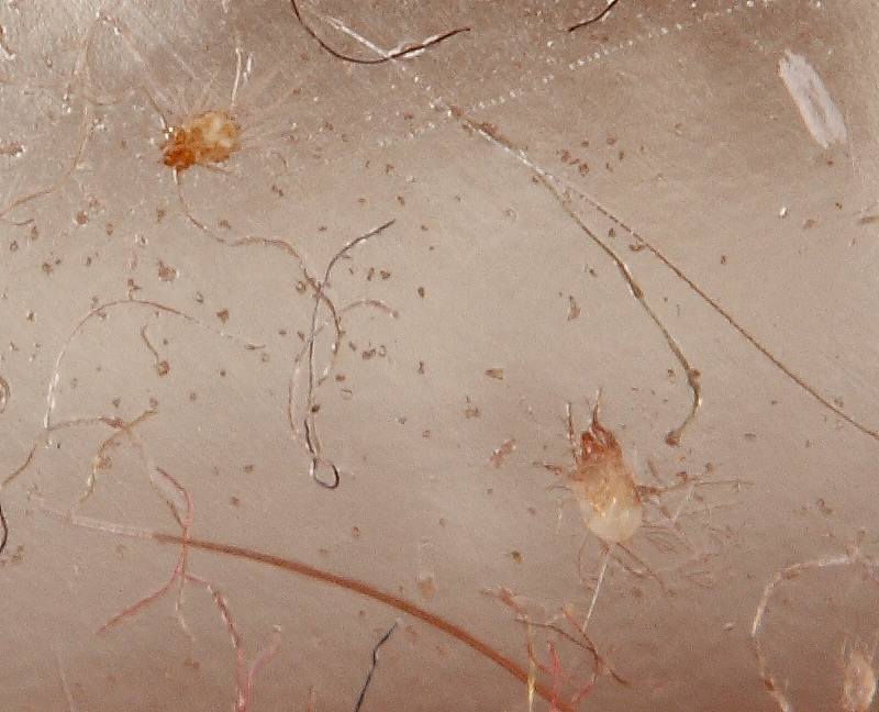 ID microacari